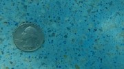 Calcium Deposit After Removal